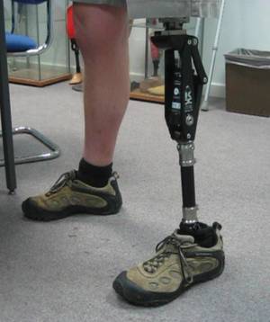 What is a Prosthetic Foot?