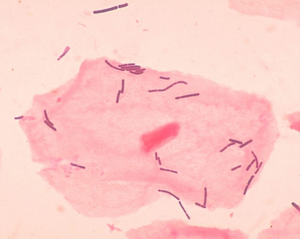 Lactobacillus organisms