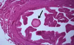 A canine egg in the oviduct after ovulation. (Image courtesy Dr. V.N. Meyers-Wallen, Cornell University).