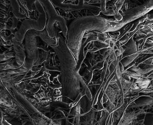 Ocular blood vessels imaged by environmental scanning electron microscopy. 