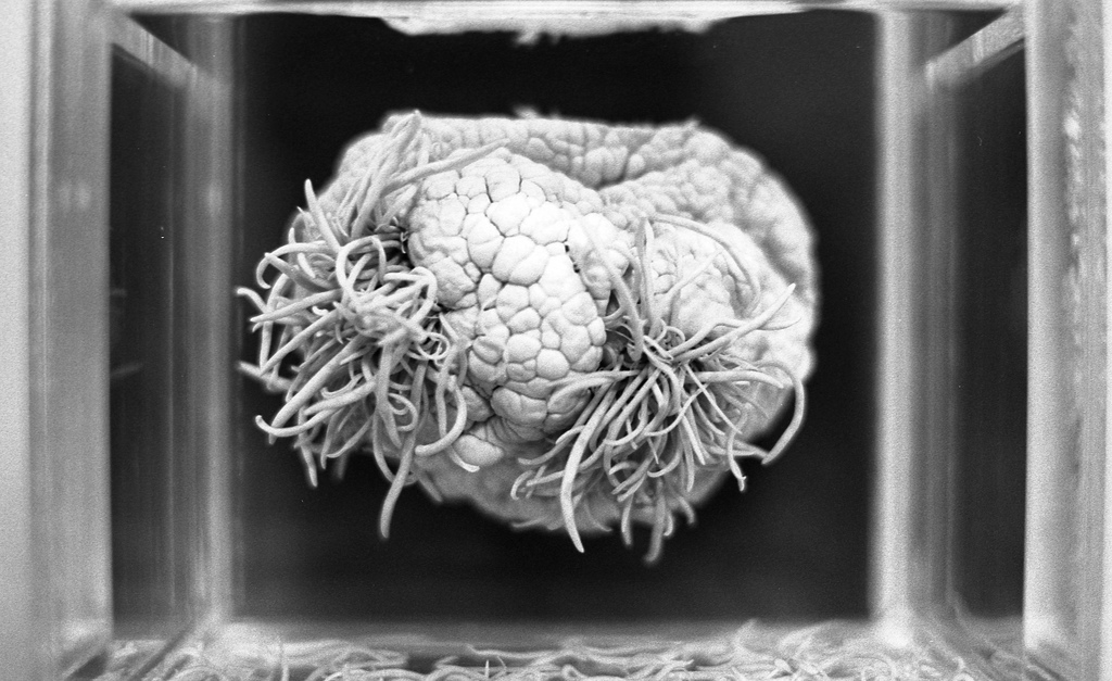 parasite worm brain