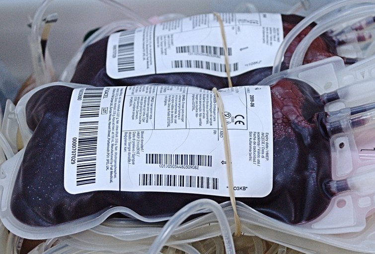 Bags of blood collected during donation, showing dark colour of venous blood.