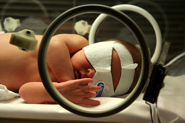 Newborn infant undergoing phototherapy to treat neonatal jaundice