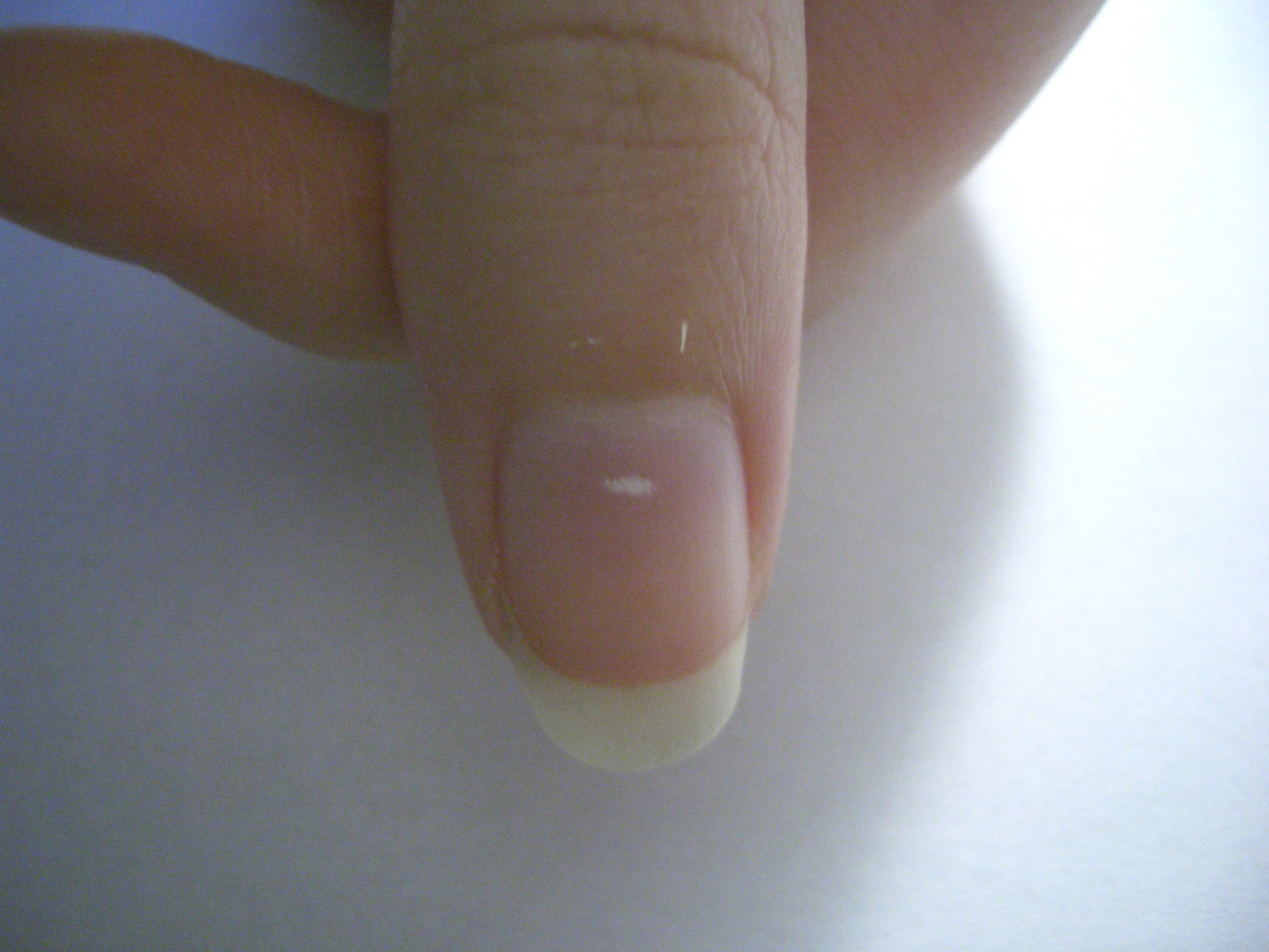 Myth: Why we get white spots on nails | Interviews | Naked Scientists