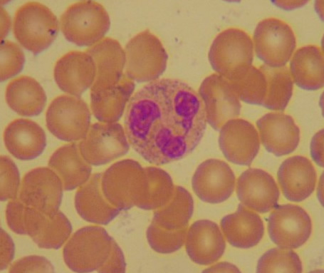 Polymorph Cell