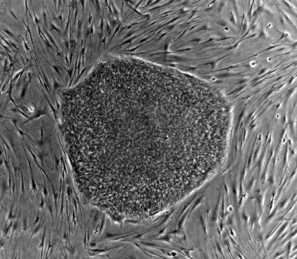 Human Embyonic Stem Cells