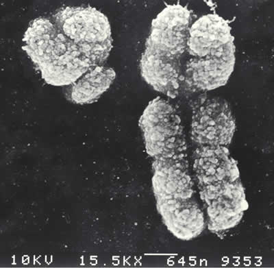 X & Y Chromosomes