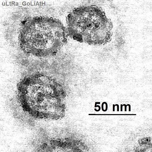 Electron microscope of Hepatitis C Virus