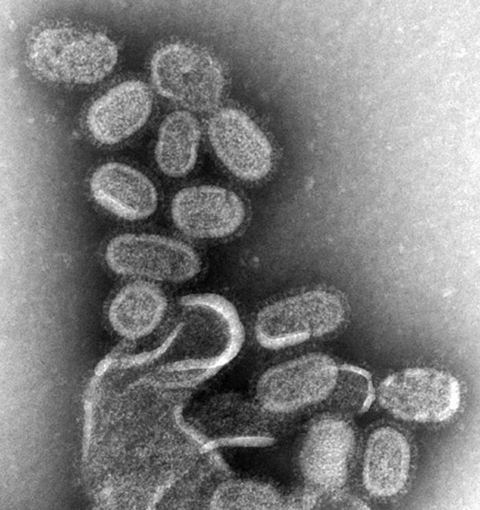Influenza virus under EM
