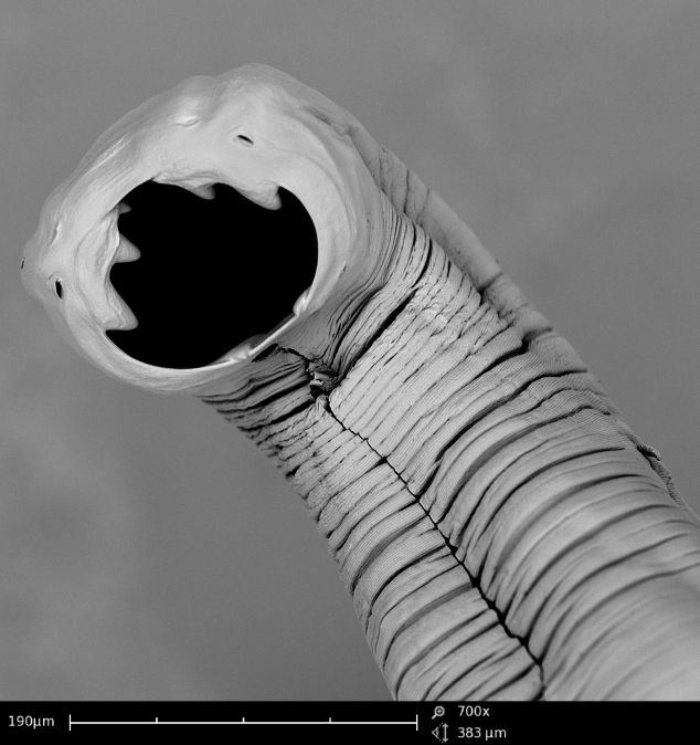 Hookworm: Necator americanus