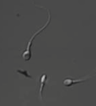 Human Sperm