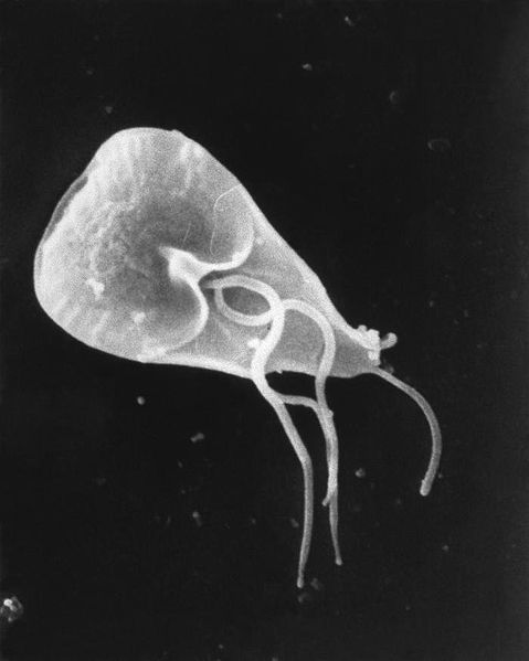 Scanning electron micrograph (SEM) of Giardia lamblia protozoan parasite