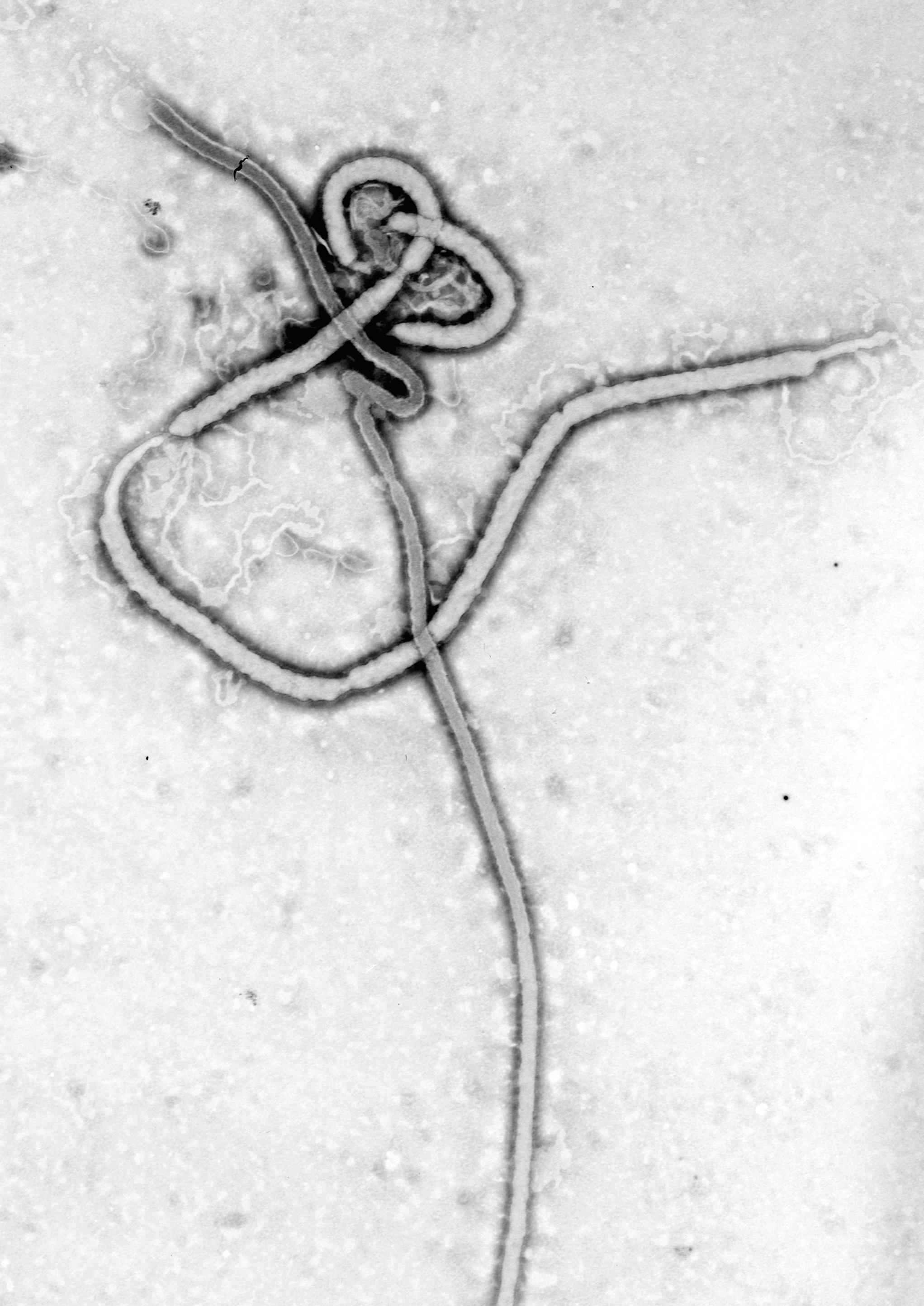 Ebola virus, as seen under an electron microscope