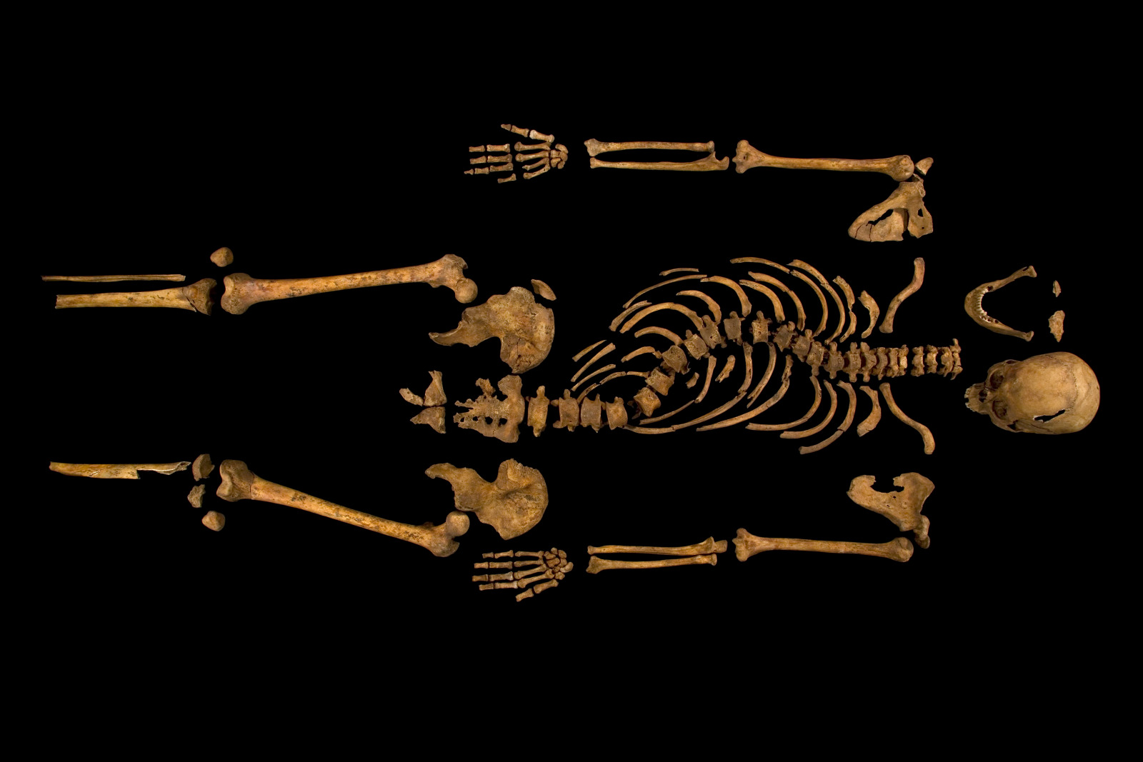 The Skeleton of King Richard III