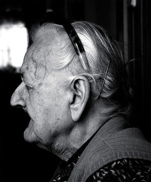The effects of old age on the human face
