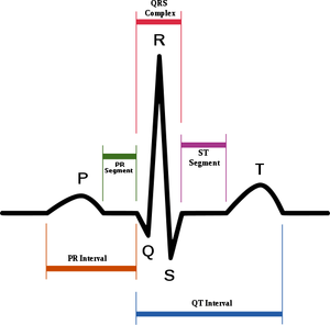 Schematic diagram of normal sinus rhythm for a human heart