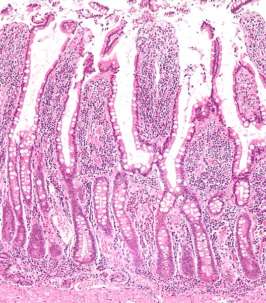 Low magnification micrograph of small intestinal mucosa. H&E stain. 