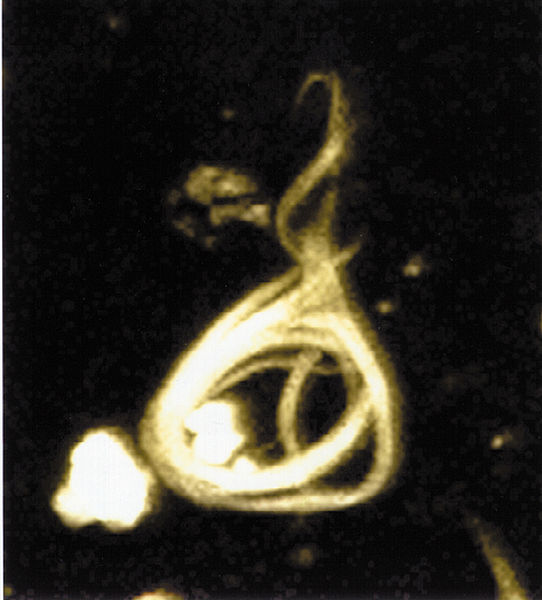 Tangled insoluble tau protein