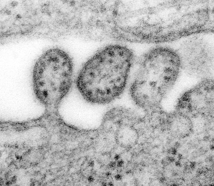 Lassa virus, an Arena virus
