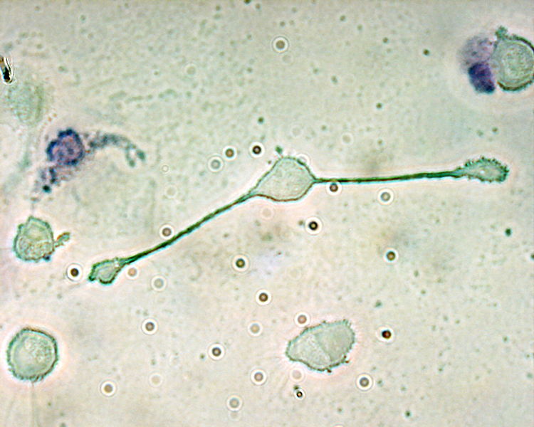 A macrophage of a mouse forming two processes to phagocytize two smaller particles, possibly pathogens