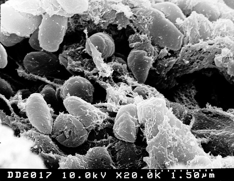 Scanning electron micrograph depicting a mass of Yersinia pestis bacteria (the cause of bubonic plague) in the foregut of the flea vector
