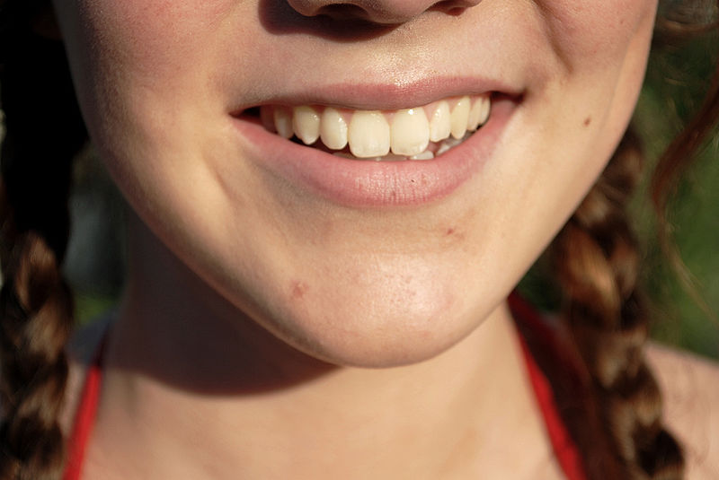 Smile