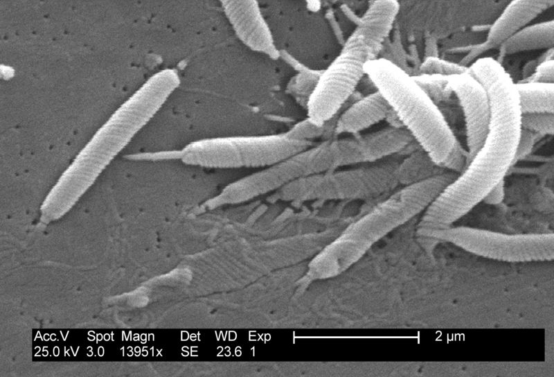 Scanning electron micrograph of Helicobacter bacteria