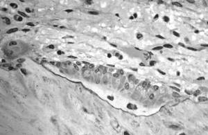 Osteoblasts actively synthesizing osteoid
