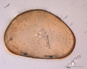 Cyclocypris ovum, one of the ostracode species useful in deciphering previous climate conditions.