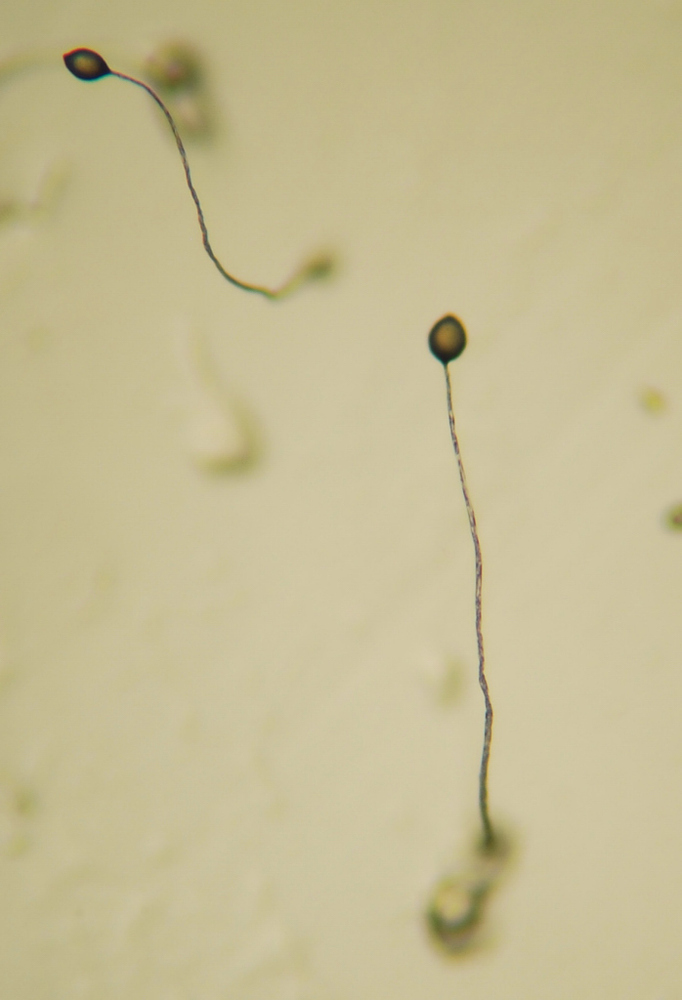 Dictyostelium Fruiting Body