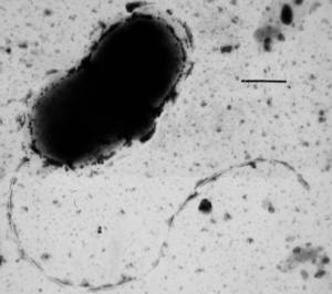 Transmission electron micrograph of sulphate reducing bacterium; Desulfovibrio vulgaris