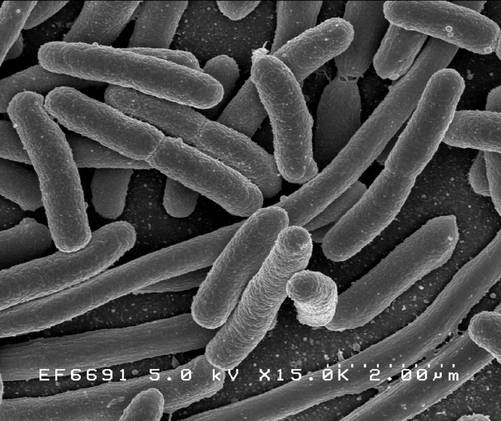 Electron Micrograph of E. coli