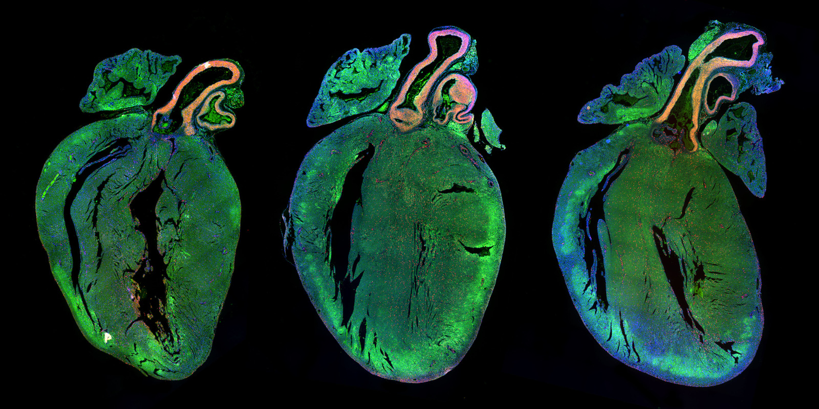 Neonatal rat hearts treated with a control microRNA (left) or two human microRNAs strongly increasing cardiomyocyte proliferation (middle and right).