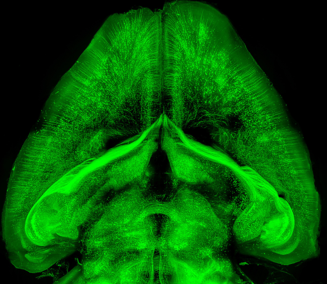 Neuronal structures in a mouse brain visualised using 3DISCO - 3D imaging of solvent-cleared organs