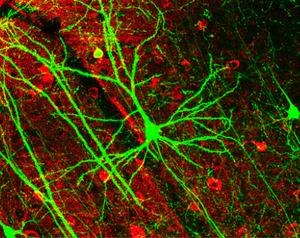 GFP-expressing nerve cells in the mouse cerebral cortex