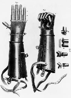 A 16th Century prosthetic hand