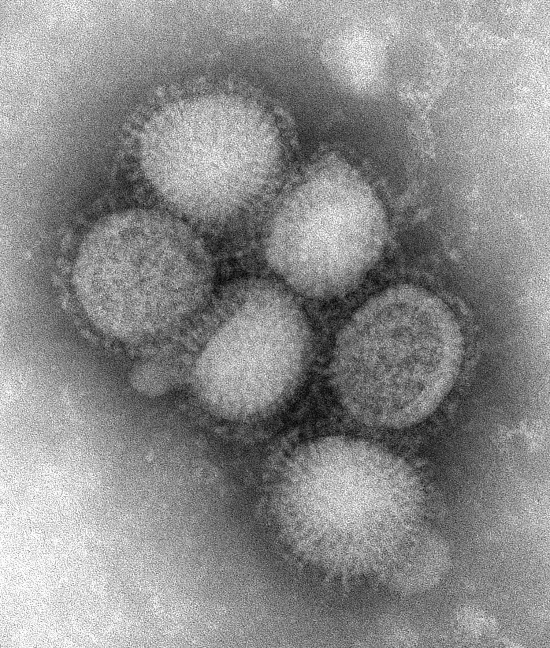 Electron micrograph showing several particles of the H1N1 influenza virus. Each particle measures about 100nm in diameter.