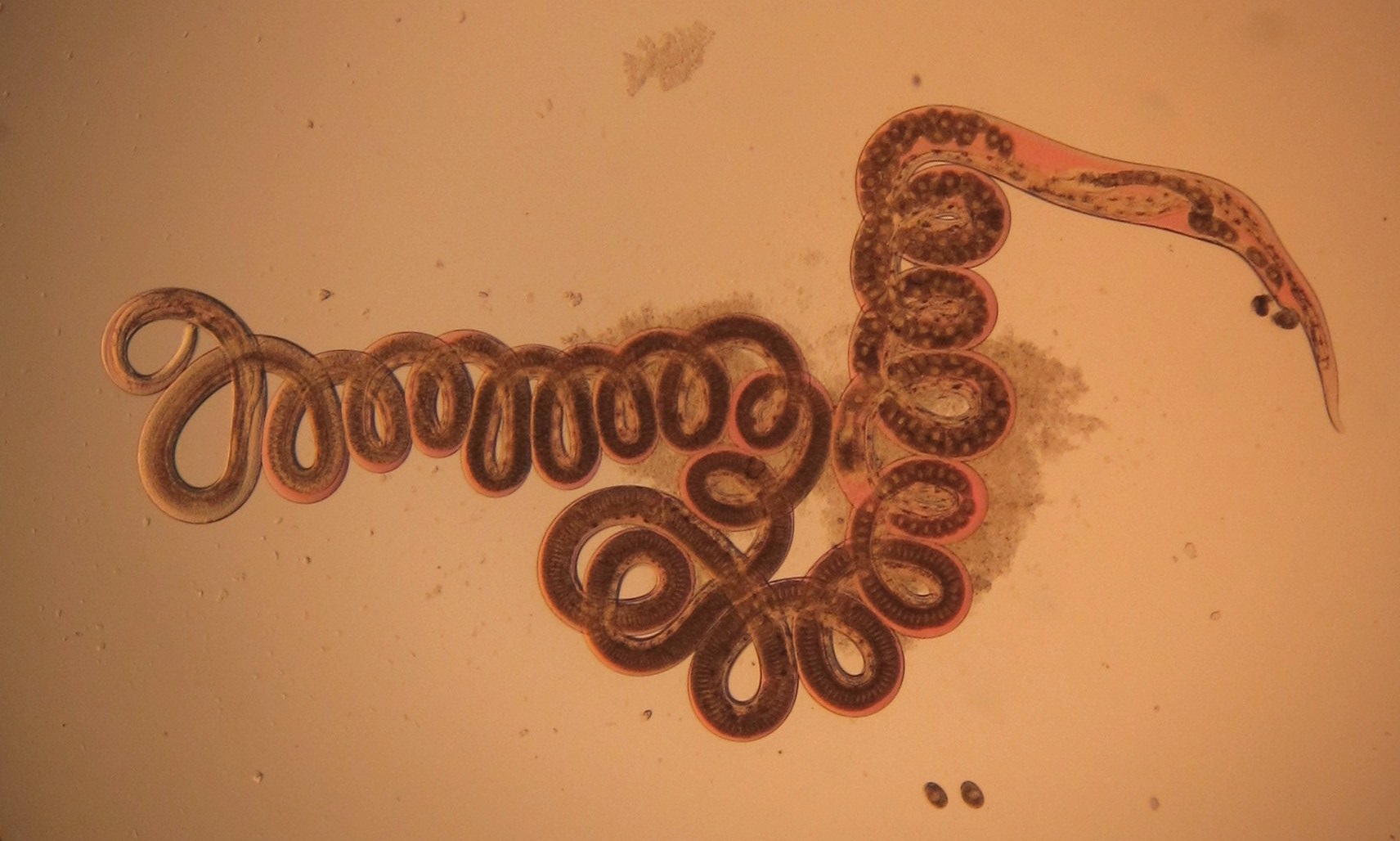 The nematode Heligmosomoides polygyrus, seen via optical microscope. Taken from the digestive tract of a wood mouse (Apodemus sylvaticus).