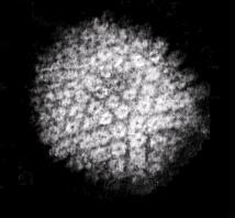 Microscopy image of a herpes virus.