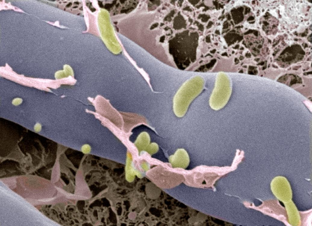 Bacteria and fungi
