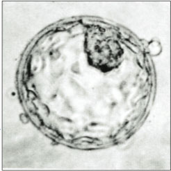 Image of human blastocyst showing Inner Cell Mass (top, right) and Trophectoderm.