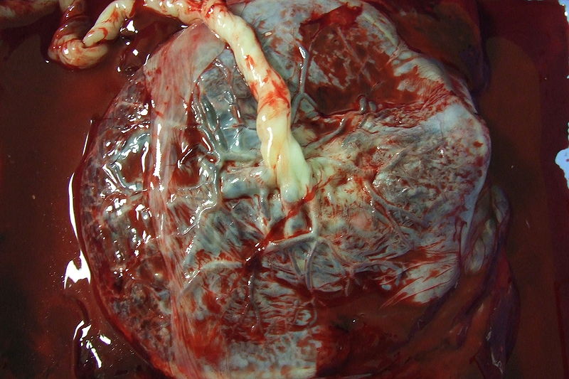 Human placenta