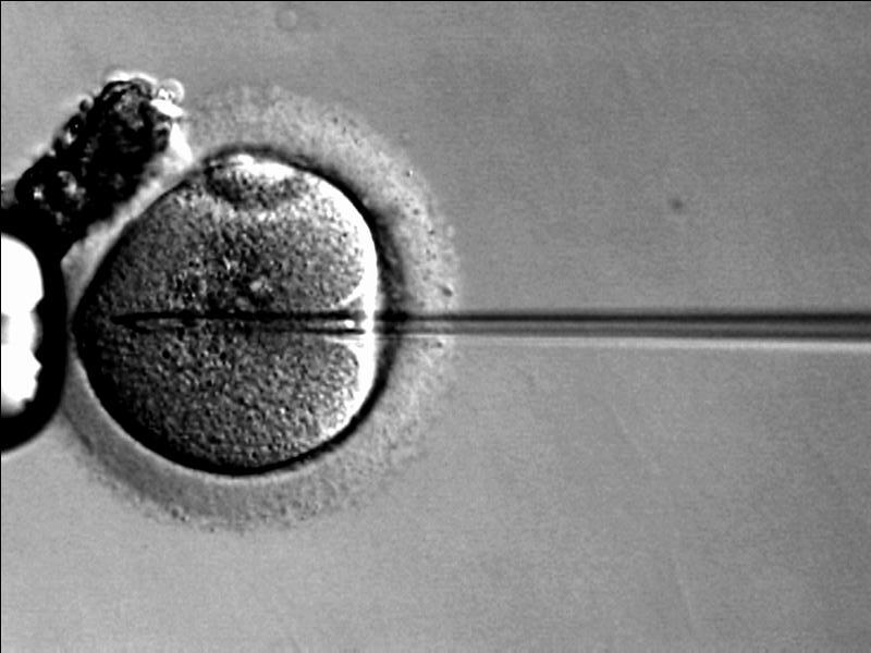 IVF technology
