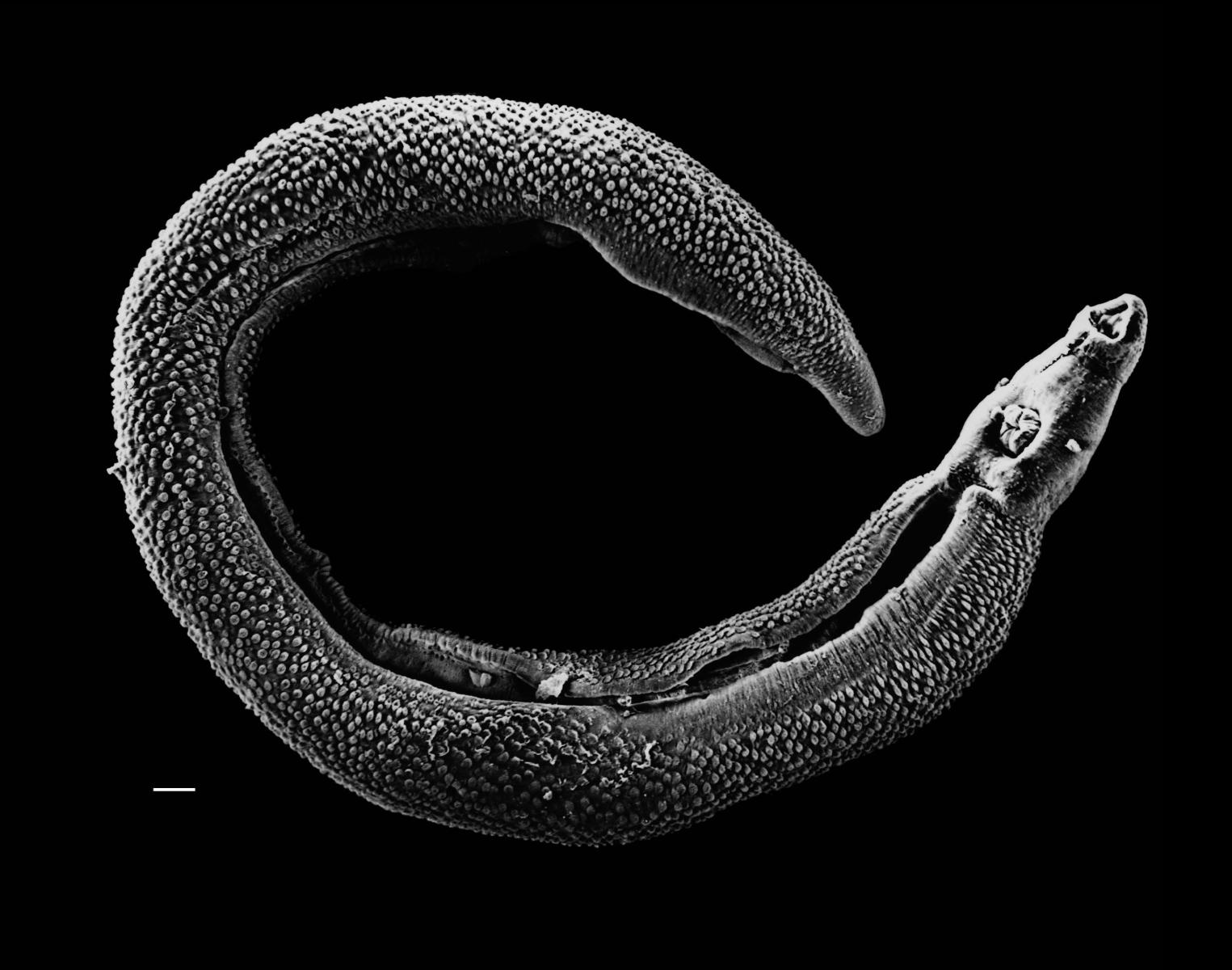 Electron micrograph of Schistosoma mansoni