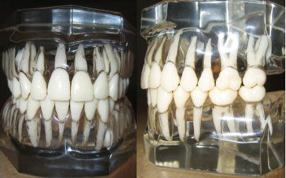 Models of human teeth as they exist within the alveolar bone