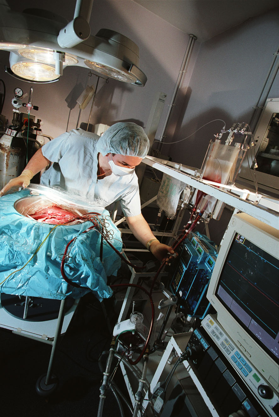 The isolated Normothermic liver perfusion device, showing a liver that has been kept alive outside the body for more than 24 hours, whilst exhibiting normal synthetic, metabolic and haemodynamic function.