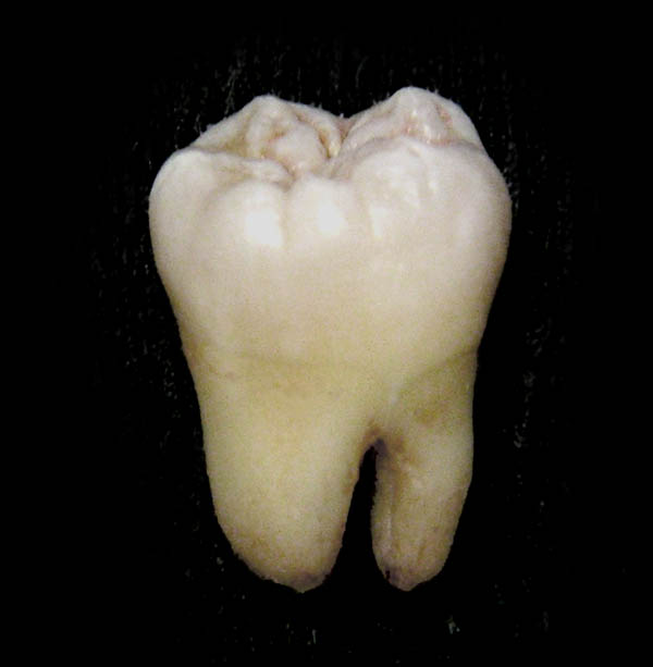 Human tooth