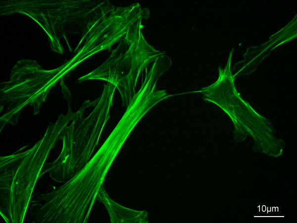 Actin microfilaments