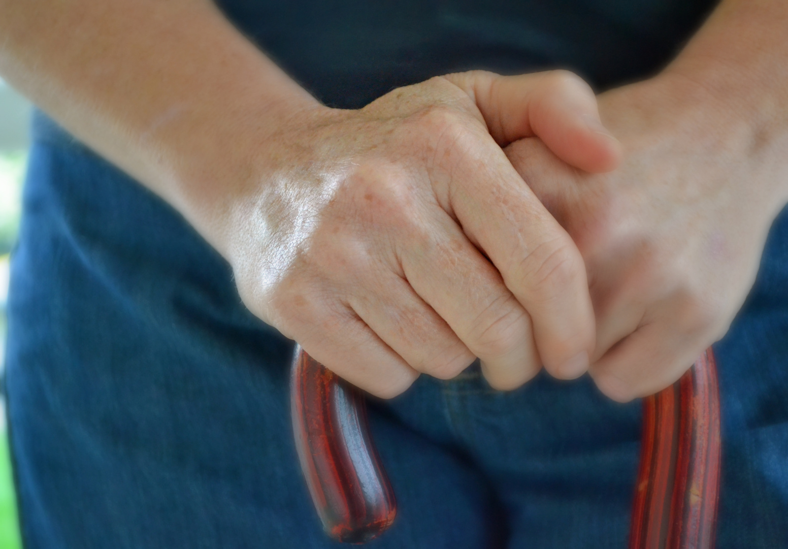 Multiple Sclerosis Hands