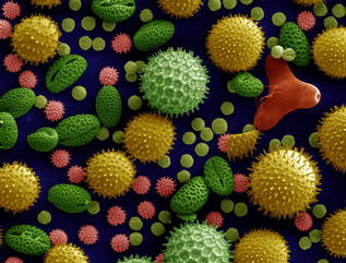 Pollen viewed under electron microscope